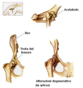 anca3